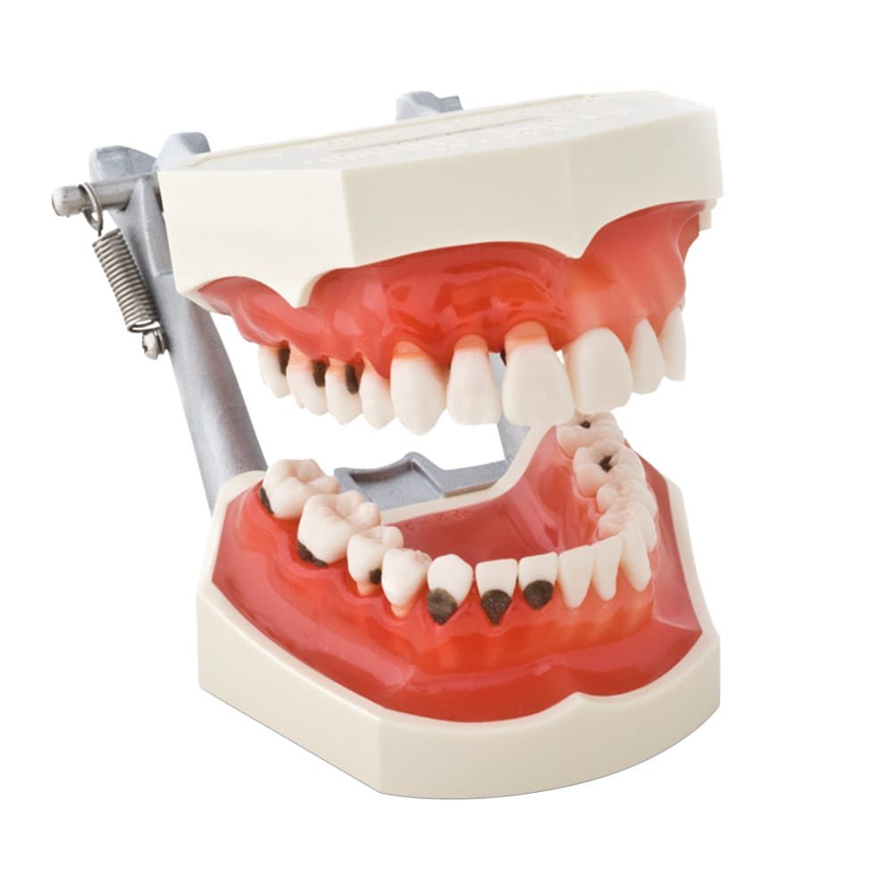Demonstrationsmod. Endo P23-END2 St