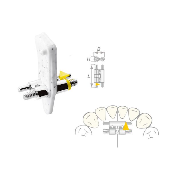 Dehnschraube Vector 080 medium 10St